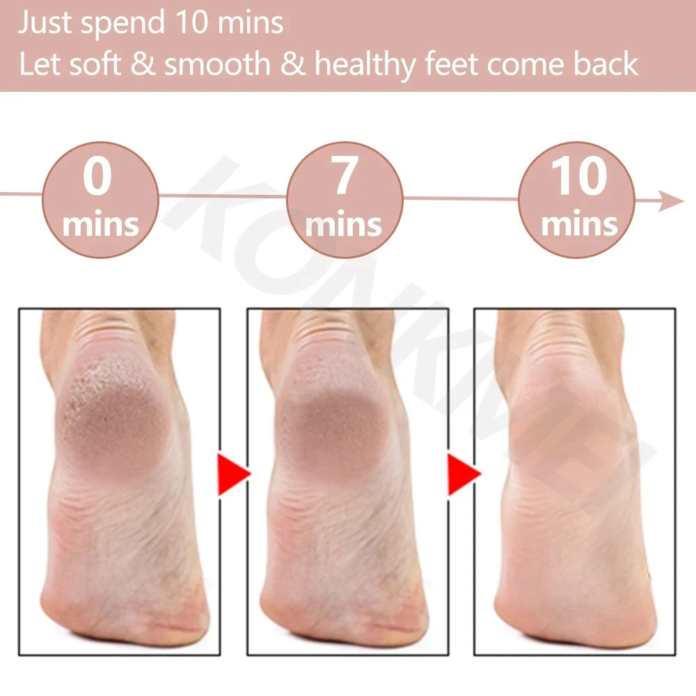 Electric Foot File Grinder Set Dead Skin Dry Callus Remover Rechargeable Roller Feet Pedicure Tool with 2 Removable Roller Heads