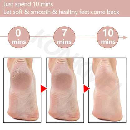 Electric Foot File Grinder Set Dead Skin Dry Callus Remover Rechargeable Roller Feet Pedicure Tool with 2 Removable Roller Heads